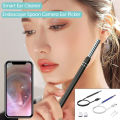 Smart Ear Cleaner Endoscope with Camera, Wifi Ear Picker, Stainless Steel Ear Spoon, Compatible with Android, MacBook, Windows PC, 12CM Stick Length. 
