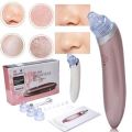 Cw-666 Electric Pimple & Blackhead Remover - Pink. 