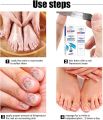 Aichun Beauty Nail Repair Cream Toenails Fingernails Care Anti Fungus Restores Damaged Nails Nourishes-20g. 