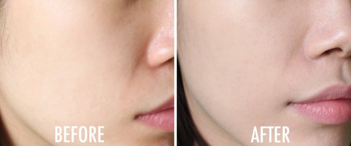 ATOMY%C2%A0BB%20Cream%C2%A0SP30%20PA++%2040ml%20-%20Image%206