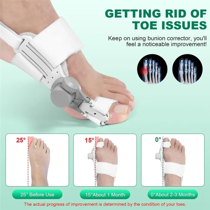 Bunion%20Corrector%20for%20Women%20Big%20Toe,%201PCS%20Bunion%20Corrector,%20Left%20Foot%20-%20Image%207