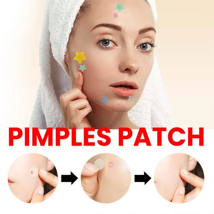 New%20200pcs%20Star%20Pimple%20Patch%20Acne%20Colorful%20Invisible%20Acne%20Removal%20Skin%20Care%20Stickers%20Face%20Spot%20Beauty%20Makeup%20Tool%20-%20Image%202