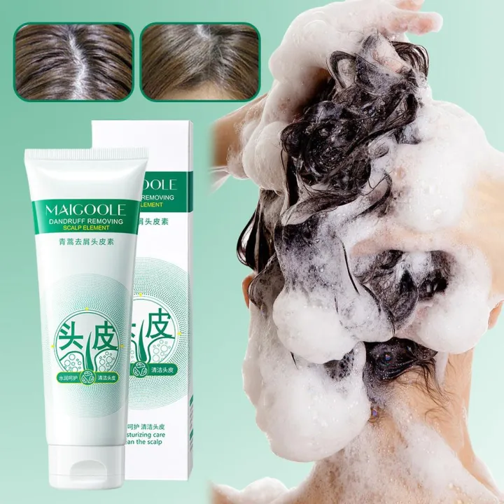 Maigoole%20Scalp%20Shampoo%20Scalp%20Shampoo%20Conditioner%20Deep%20Cleaning%20Scalp%20Refreshing%20Control%20Oil%20For%20Men%20Women%20W3c5%20-%20Image%202