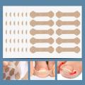 New Ingrown Paronychia Toenail Corrector Strips Anti Fungal Nail Correction Stickers Anti Infection Nail Treatment Patch. 