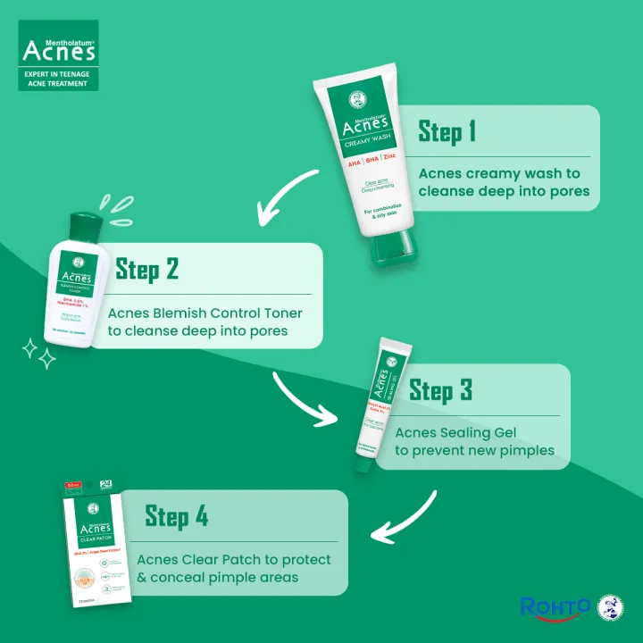 Rohto%20Mentholatum%20Acnes%20Clear%20Patch%20For%20Pimple%20Treatment%20(24%20Patches)%20-%20Image%204