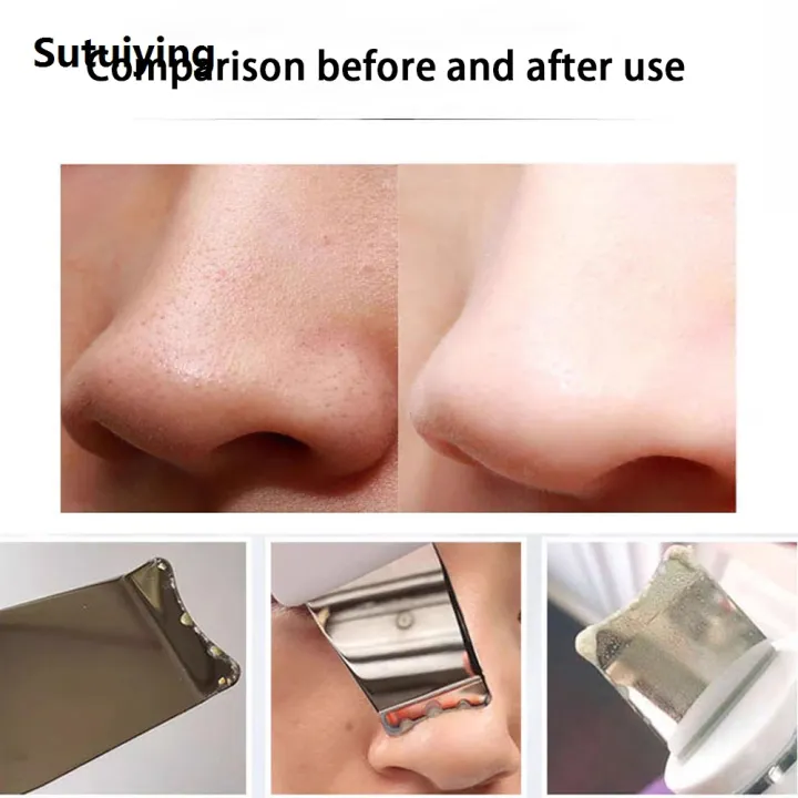 Sutuiying Blackhead Remover Deep Facial Cleansing Spatula Face Cleaning ...