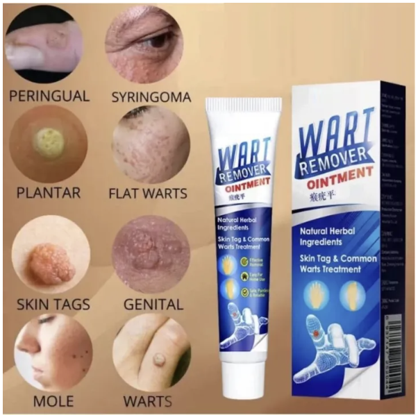 Wart Remover creaml | Skin Tag Remover cream | massa remover ointment for skin | Painless Wart & Skin Tag Removal-20g