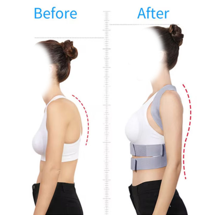 Adjustable%20Back%20Posture%20Corrector%20Belt:%20Clavicle,%20Spine,%20and%20Lumbar%20Support%20for%20Effective%20Posture%20Correction%20-%20Image%202