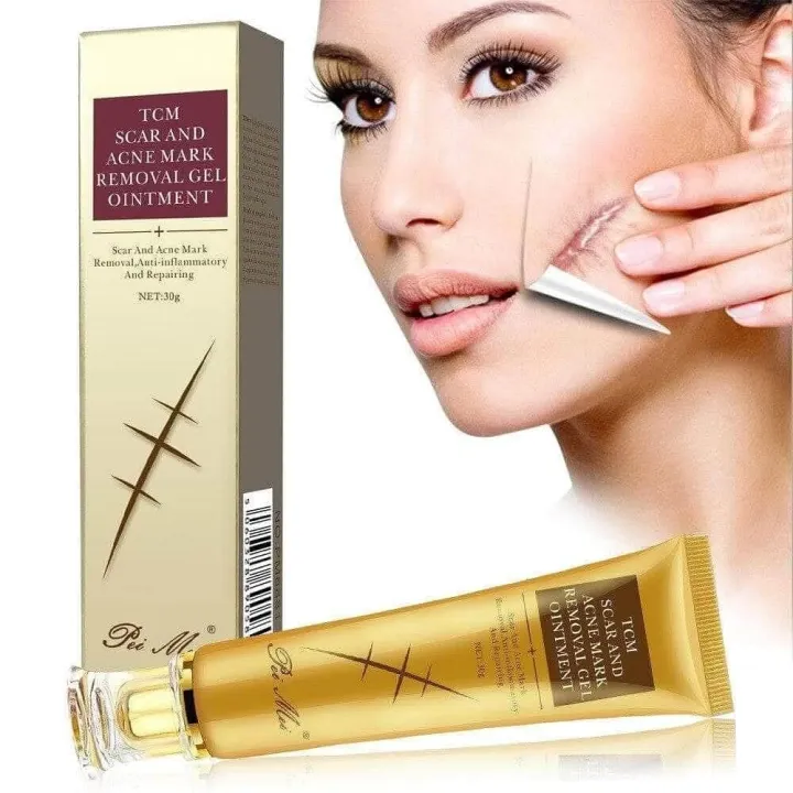 TCM%20Scar%20and%20Acne%20Marks%20Removal%20Gel,%20Scars,%20Burns,%20Stretch%20Marks,%20Acne%20Spots,%20Treatment%20Gel%20Ointment%20for%20Face%20and%20Body%2030g%20-%20Image%202
