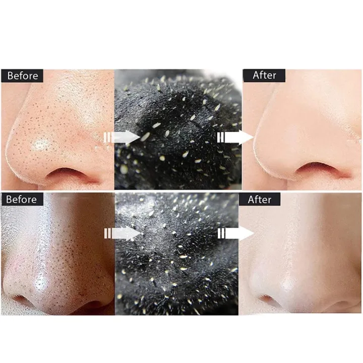 Black%20Head%20Remover%20Mask%20Black%20Face%20Mask%20Acne%20Treatments%20Peel%20Off%20Black%20Mask%20From%20Black%20Dots%20Skin%20Care%203/5/10/packs%20-%20Image%204