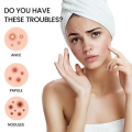 Acne Pimple Master Patch – Transparent Hydrocolloid Spot Treatment for Clear Skin | Korean Beauty Secret (36 Pcs). 