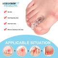 DISICHEN Profesional 2pieces=1pair Toe Orthosis Clip Pads Big Foot Bone Care Tools Splitter Thumb Hallux Valgus Bunion Corrector Overlap Separators. 