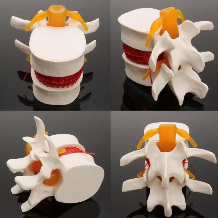 Use%203D%20Model%20Lumbar%20Model%20Compression%20Demonstration%20Spinal%20Pressure%20Lesions%20Human%20Anatomy%20Skeleton%20Model%20Educational%20Tool%20Simulation%20Spine%20Demonstration%20Structure%20Student%20-%20Image%205