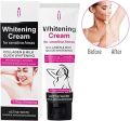 Aichun Beauty 50g Skin Lightening Cream for Dark Skin,  Moisturizing, Effective for Armpits, Knees, Elbows. 