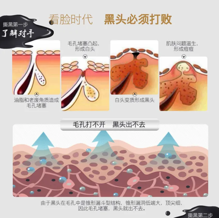 Black%20Head%20Remover%20Mask%20Black%20Face%20Mask%20Acne%20Treatments%20Peel%20Off%20Black%20Mask%20From%20Black%20Dots%20Skin%20Care%203/5/10/packs%20-%20Image%203