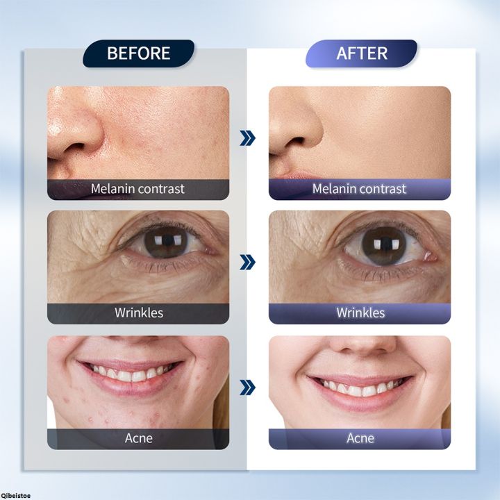 QibeistoeProfesional%20foreverlily%20LED%20Face%20Mask%20PDT%20Machine%207%20Colors%20Light%20Photon%20Skin%20Rejuvenation%20Facial%20Body%20Beauty%20Spa%20Nano%20Spray%20Face%20Body%20Mist%20-%20Image%205