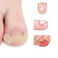 HOT Pexmen 6Pcs/Sheet Ingrown Toenail Correction Sticker Adhesive Toenail Patch Toe Nail Treatment Corrector Foot Care Tool. 