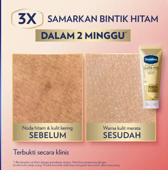 Vaseline%20Gluta-Hya%20Flawless%20Glow%20Body%20Lotion,%20330ml%20-%20Image%203