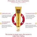 Scar Removal Cream - TCM Scar Cream for Surgical Scars, Acne Skin Care Cream, Acne Treatment Cream for Scars, Burns, Stretch Marks, Acne Spots. 