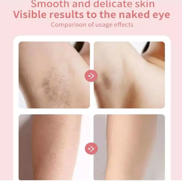 Portable%20Rechargeable%20Epilator%20Hair%20Remover%20for%20Arms,%20Legs,%20Underarms,%20Hair%20Removal%20-%20Image%206