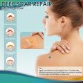 1Roll Professional Silicone Scar Sheets (Scar Tape - 150cm) Scars Treatment - Reusable Silicone Scar Strips Type for Keloid,Burn. 