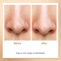 FURR By Pee Safe Bamboo Charcoal Nose Strips – Blackhead Remover & Deep Pore Cleansing | 3 Strips. 