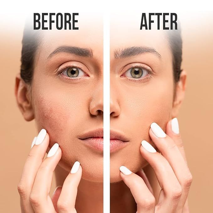 Furr%20By%20Pee%20Safe%202%25%20Salicylic%20Acid%20&%20Green%20Tea%20Anti%20Acne%20Face%20Wash%20-%20100Ml%20-%20Image%205