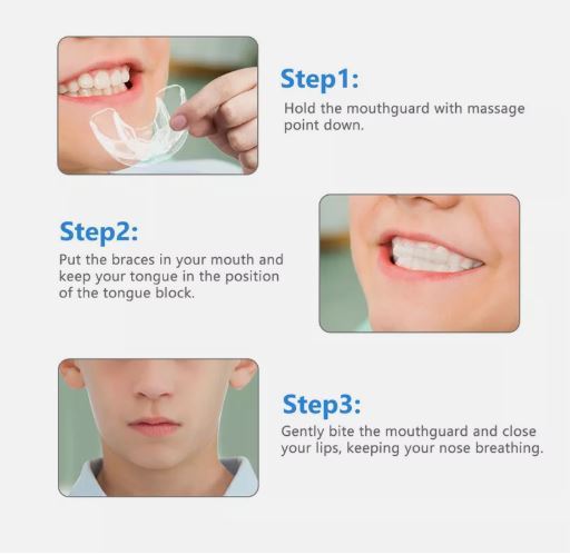 3%20In%201%20Dental%20Orthodontic%20Teeth%20Corrector%20Mouth%20Guard%20Braces%20Retainer%20Straighten%20Tool%20-%20Image%203