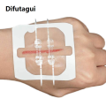 Difutagui 2025 Zip Stitch Sutures 6x7cm Skin Laceration Closures Adhesive Bandages Zipper Band aid Patch for Emergency Wound Care First Aids. 