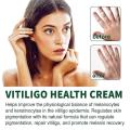 NUTRIG Vitiligo Treatment Cream for White Spots, Vitiligo Cream Treatment Ointment Leucoplia Relief Repair Melanin 20g. 