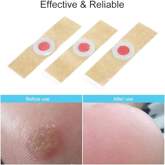 3%20Pcs%20Corn%20Remover,(Musa%20&%20Kothi%20Hataune%20)%20%20Corn%20Remover%20Seal%20&%20Heal%20Bandage%20with%20Hydrogel%20Technology%20-%20Image%203