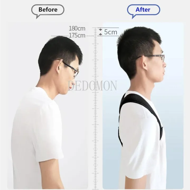 Brace%20Support%20Belt%20Adjustable%20Back%20Posture%20Corrector%20Clavicle%20Spine%20Back%20Shoulder%20Lumbar%20Posture%20Correction%20Shoulder%20Back%20Blet%20-%20Image%205