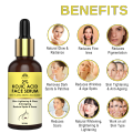 2 % Kojic Acid Face Serum For Pigmentation, Spots, Scars, Anti ageing Serum For Men & Women 30 ml. 