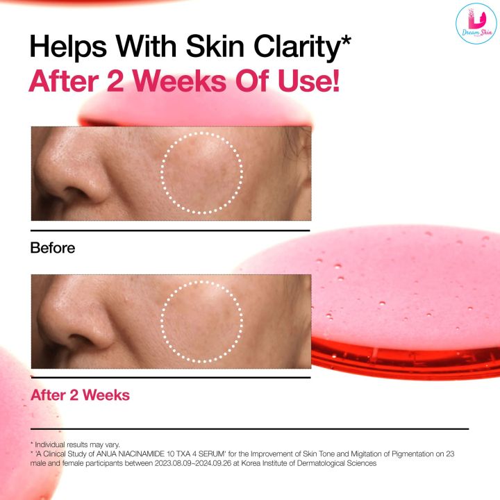 Anua%20Niacinamide%2010%25%20+%20TXA%204%25%20Serum%20%20%5B30ml%5D%20By%20Dream%20Skin%20Nepal%20-%20Image%205