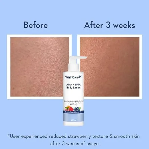 WishCare%2010%25%20AHA%20+%201%25%20BHA%20Body%20Lotion%20-%20Smooths%20Rough%20&%20Bumpy%20Skin%20-%20Glycolic%20&%20Lactic%20Acid%20Body%20Lotion%20with%20Niacinamide%20-%20200%20Ml%20-%20Image%202