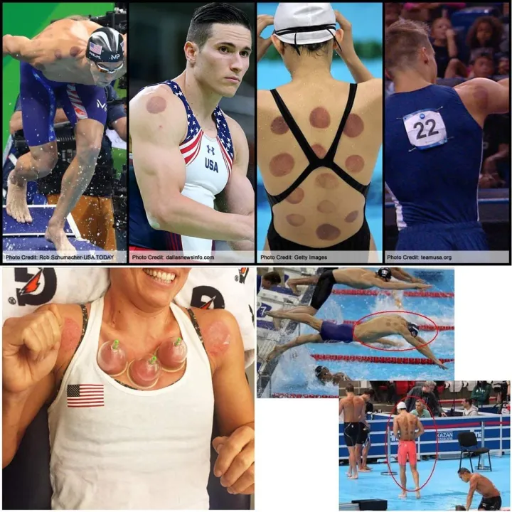 Acupoint%20Vacuum%20Magnetic%20Pump%20Cupping%20Therapy%20Kit%20-%20Image%209