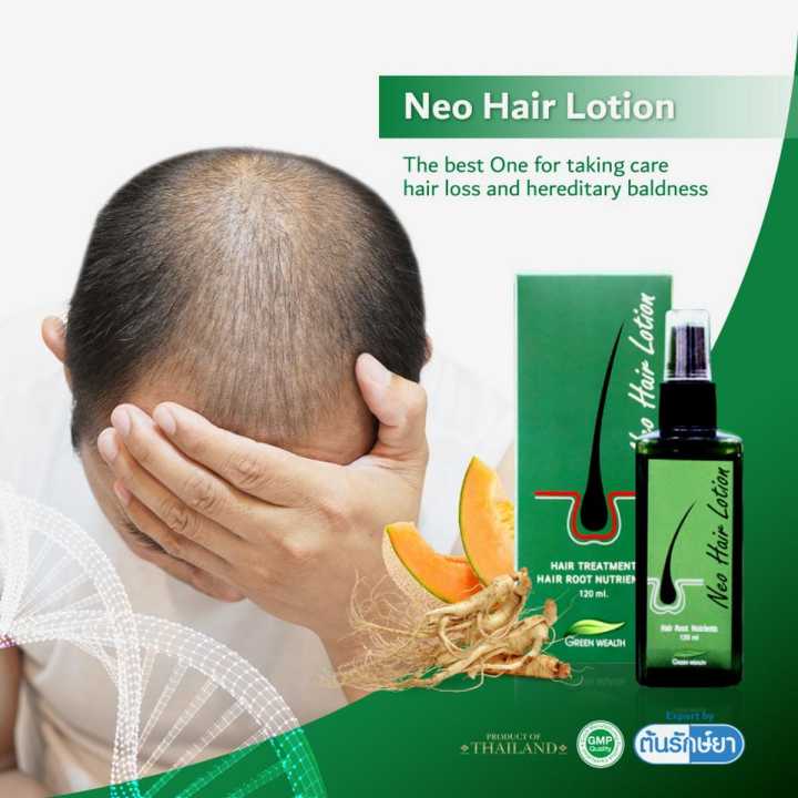 Original Neo Hair Lotion - 120ml