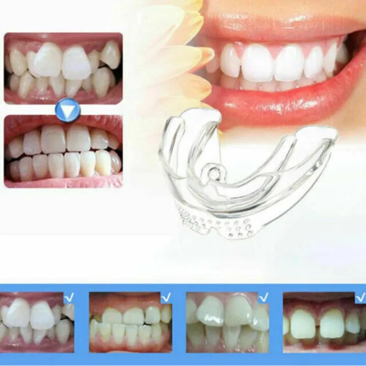 Smooth%20Dental%20Orthodontic%20Teeth%20Corrector%20l%20Dental%20Care%20Kit%20/%20Mouth%20Guard%20Braces%20Retainer%20Straighten%20Tool%20-%20Image%204