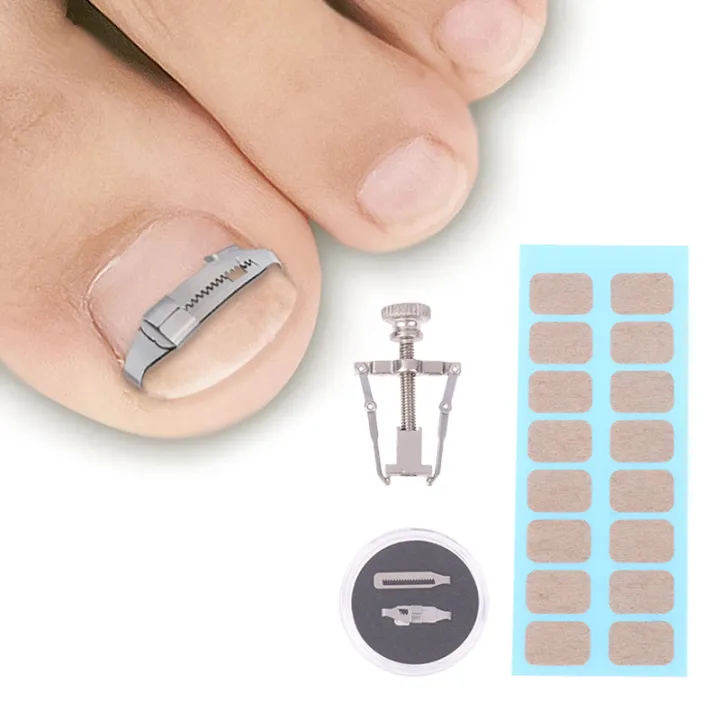 1%20Set%20Ingrown%20Toenail%20Corrector%20Tools%20Pedicure%20Recover%20Embed%20Toe%20Nail%20Treatment%20Professional%20Foot%20Care%20Correction%20Tool%20-%20Image%202
