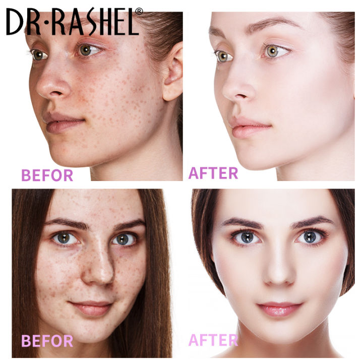 Dr.Rashel%20Vitamin%20E%20Dark%20Spots%20Corrector%20Face%20Serum%20For%20Pigmentation%20-%2030ml%20-%20Image%204