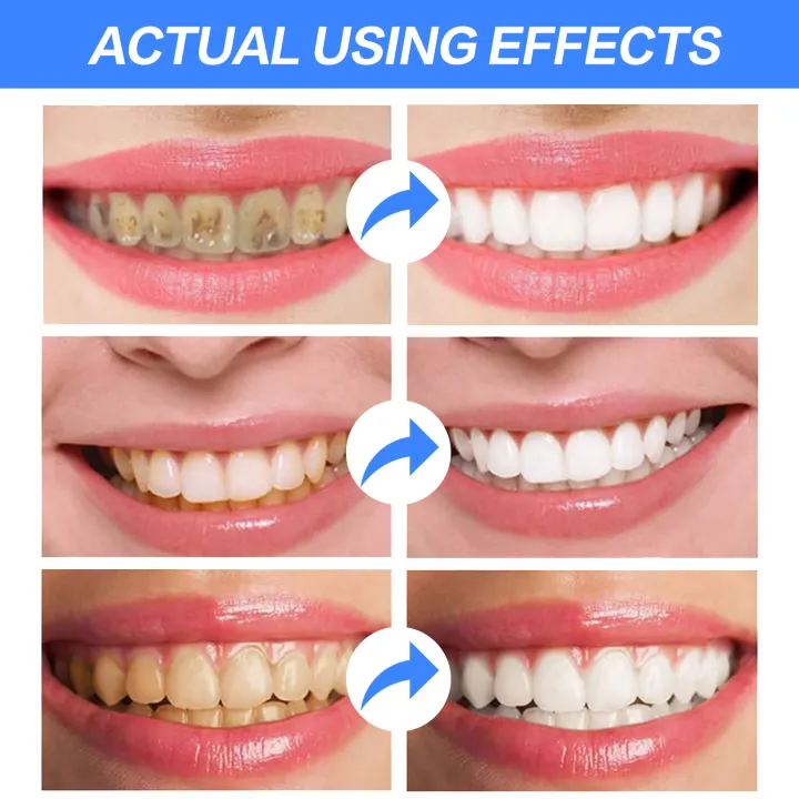 OEM%20Private%20Label%20Fruit%20Flavor%20Soda%20Whitening%20Toothpaste%20Teeth%20Cleaning%20Stains%20Removal%20High%20Quality%20Oral%20Healthy%20Toothpaste%20-%20Image%203