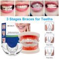 Dental Orthodontic Teeth Corrector Braces Tooth Retainer | Removable Teeth Straightening Trainer Tool | Reusable Dental Alignment Corrector for Oral Care, Smile Support & Teeth Positioning (Adults & Teens). 