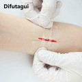 Difutagui 2025 Zip Stitch Sutures 6x7cm Skin Laceration Closures Adhesive Bandages Zipper Band aid Patch for Emergency Wound Care First Aids. 
