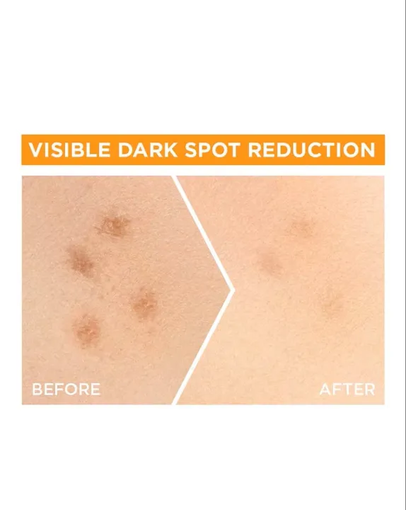 Garnie%20Bright%20Complete%20VITAMIN%20C%20Booster%20Face%20Serum%20-%2030ml%20-%20Image%205