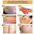 TCM Scar and Acne Marks Removal Gel, Scars, Burns, Stretch Marks, Acne Spots, Treatment Gel Ointment for Face and Body 30g. 
