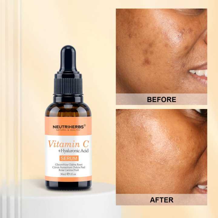 Neutriherbs%20%20Vitamin%20C%20Serum%2030ml%20By%20Dc%20International%20-%20Image%206