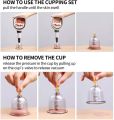Acupoint Vacuum Magnetic Pump Cupping Therapy Kit. 