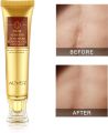 Original Scar and Acne Mark Removal Gel Stretch Marks/acne/scald/surgical Scars Treatment Cream Skin Care 30 Gram. 