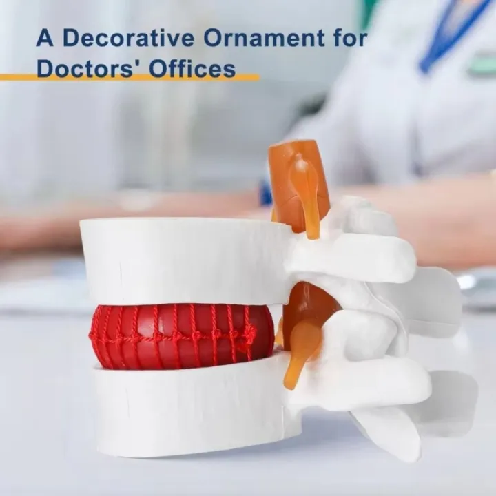 High%20Quality%203D%20Model%20Lumbar%20Model%20Compression%20Demonstration%20.5X%20Enlarge%20Human%20Anatomy%20Skeleton%20Model%20Spinal%20Pressure%20Lesions%20Simulation%20Lumbar%20Disc%20Herniation%20Teaching%20Tool%20Nursing%20-%20Image%203