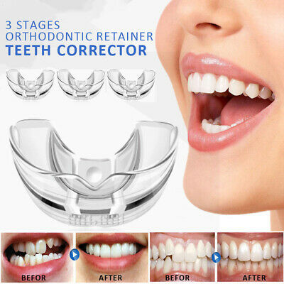 3%20In%201%20Orthodontic%20Retainer/Teeth%20Corrector%20-%20Image%203
